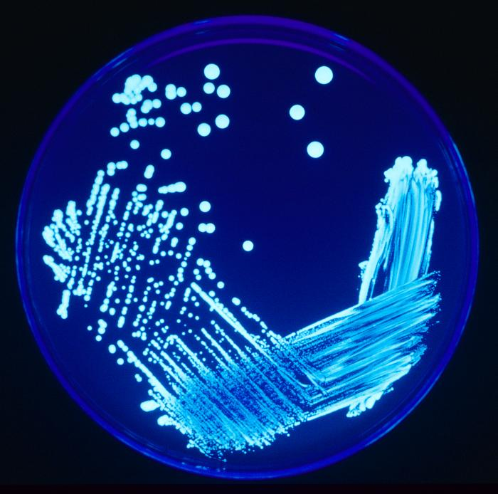 Piastra con legionella.